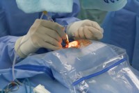 Surgeon Operationg Hymenoplasty